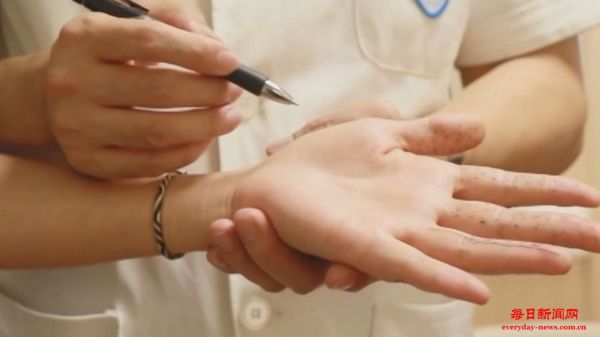 中年女性患“鼠标手”的概率更大 “鼠标手